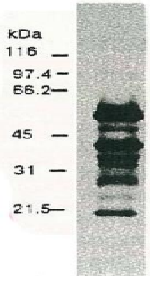 Anti-Hepatitis C Virus NS5a Antibody (Biotin) [8926]