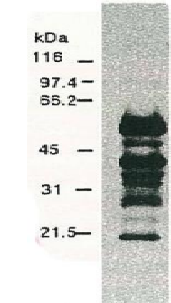 Anti-Hepatitis C Virus NS5a Antibody (FITC) [8926]