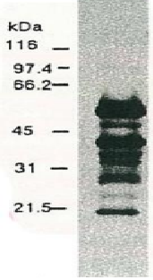 Anti-Hepatitis C Virus NS5a Antibody [8926]