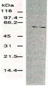 Anti-Hepatitis C Virus NS5b Antibody [NS5B-6]