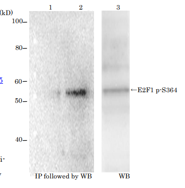 Anti-E2F1 (phospho Ser364) Antibody [#2]