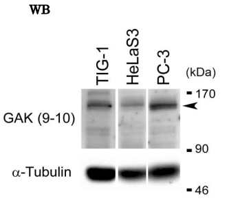 Anti-GAK Antibody [9-10]