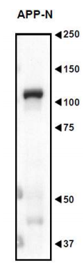 Anti-Amyloid Precursor Protein Antibody