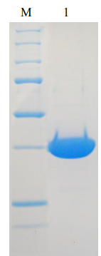 Recombinant Rat DNA Polymerase beta Protein (Functional)