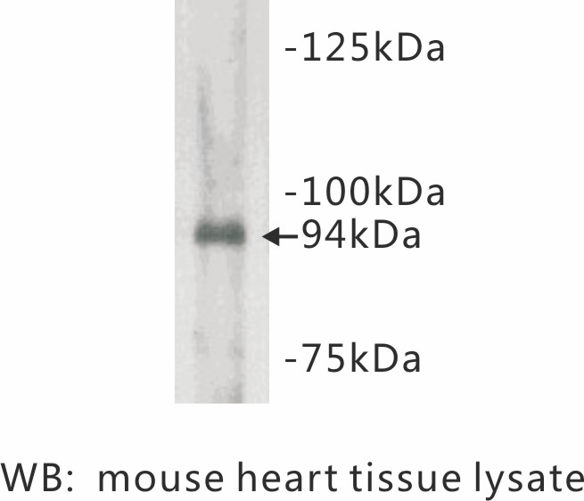 Anti-Junctophilin 2 Antibody [D5-3]