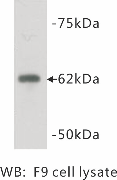 Anti-PGBD5 Antibody