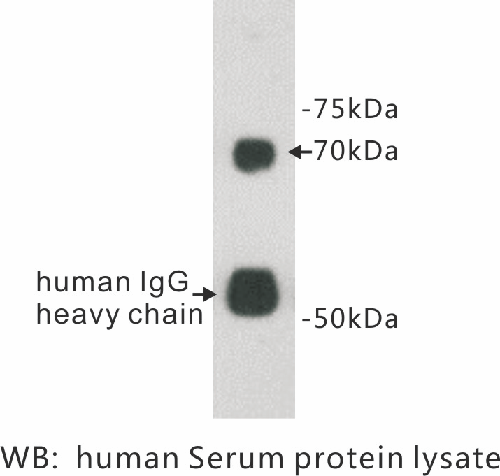 Anti-Protein S Antibody