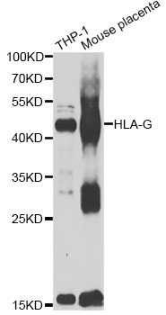 Anti-HLA-G Antibody