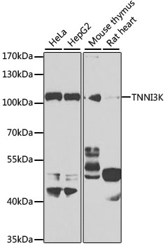 Anti-TNNI3K Antibody