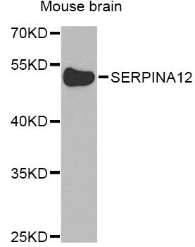 Anti-SERPINA12 Antibody