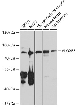 Anti-e-LOX-3 Antibody