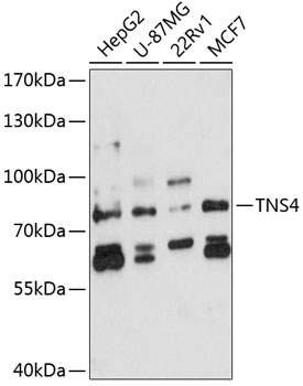Anti-TNS4 / CTEN Antibody