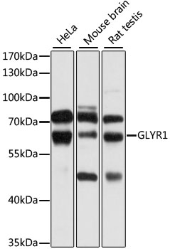 Anti-GLYR1 Antibody