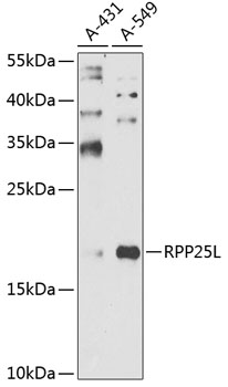 Anti-RPP25L Antibody