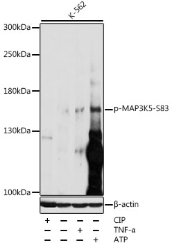 Anti-ASK1 (phospho Ser83) Antibody