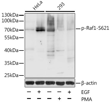 Anti-Raf1 (phospho Ser621) Antibody