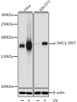 Anti-SMC1A (phospho Ser957) Antibody