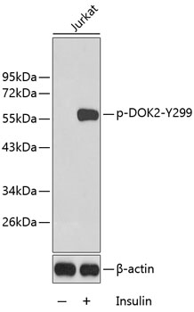 Anti-DOK2 (phospho Tyr299) Antibody - Identical to Abcam (ab194772)