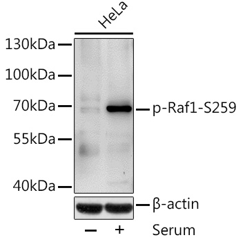 Anti-Raf1 (phospho Ser259) Antibody