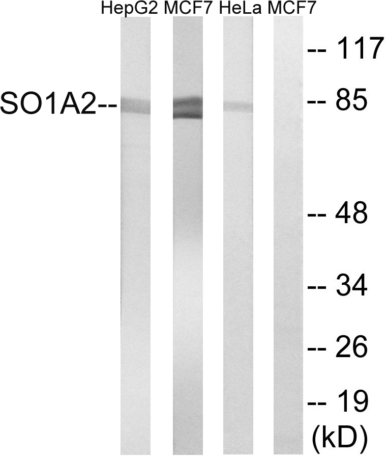 Anti-SLCO1A2 Antibody