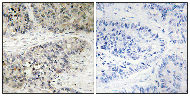 Anti-MAPK15 Antibody