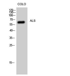 Anti-IGFALS Antibody