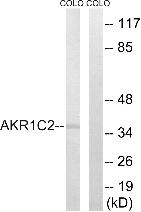 Anti-AKR1C2 Antibody