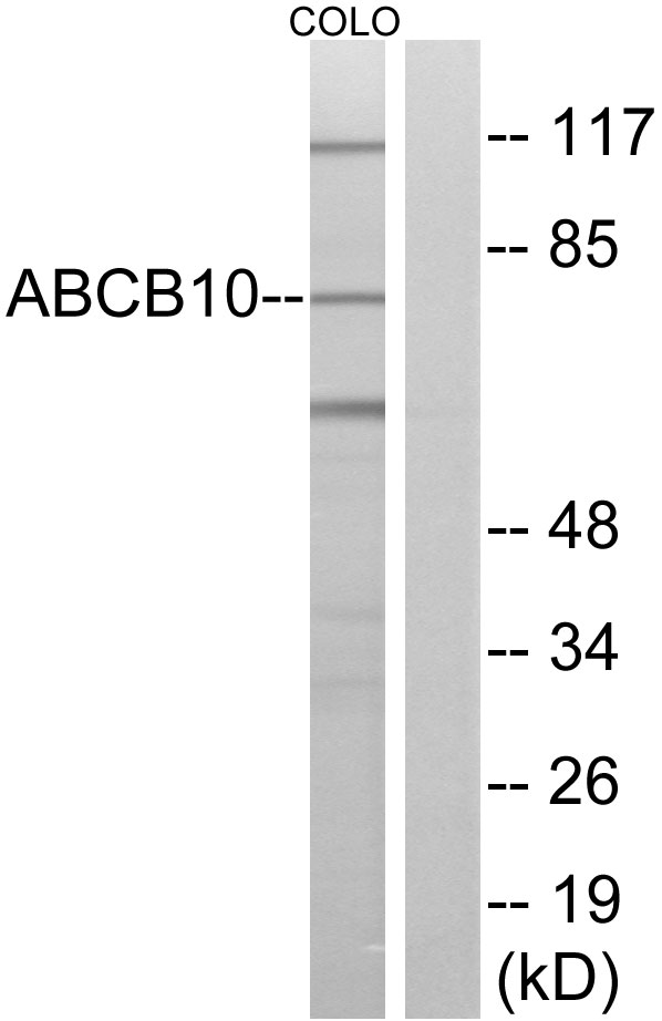 Anti-ABCB10 Antibody