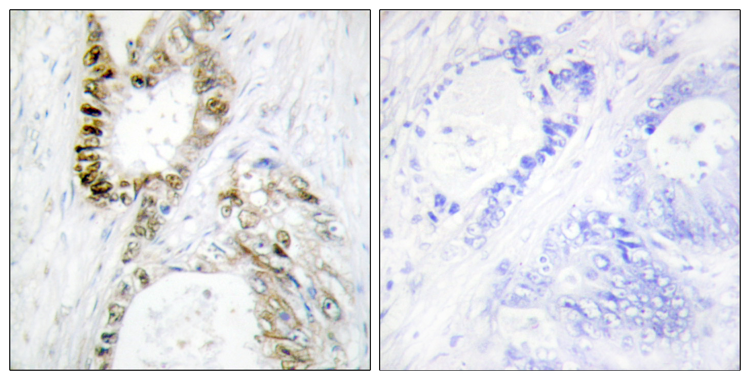 Anti-FANCA Antibody