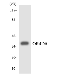 Anti-OR4D6 Antibody