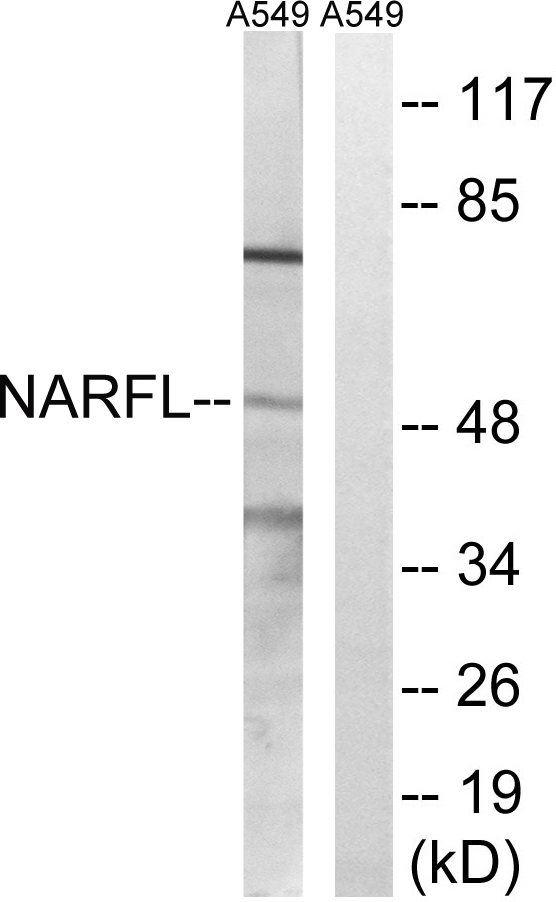 Anti-NARFL Antibody