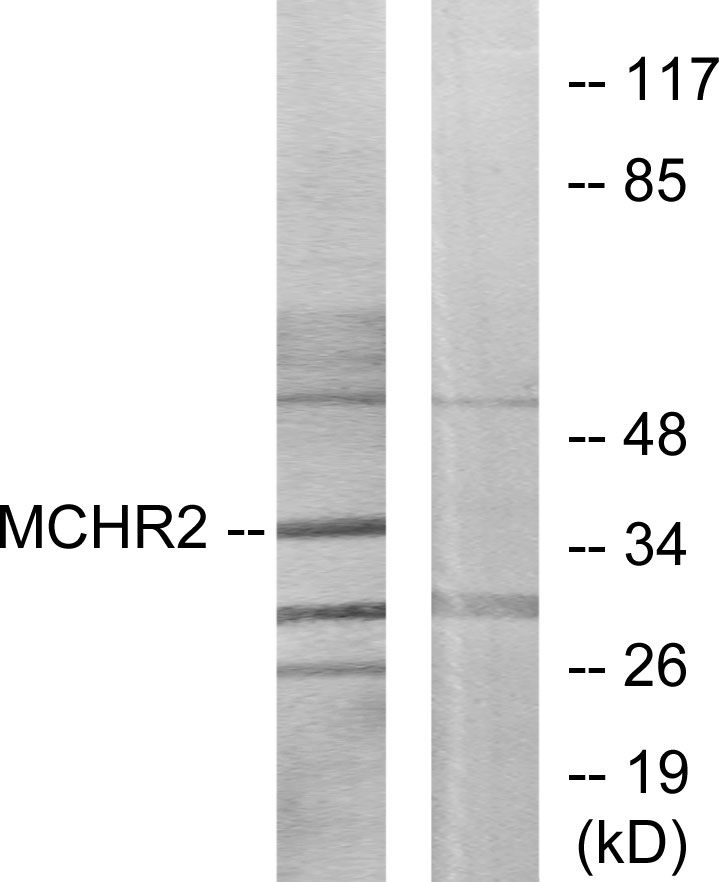 Anti-MCHR2 Antibody