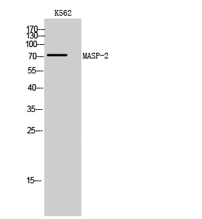 Anti-MASP2 Antibody