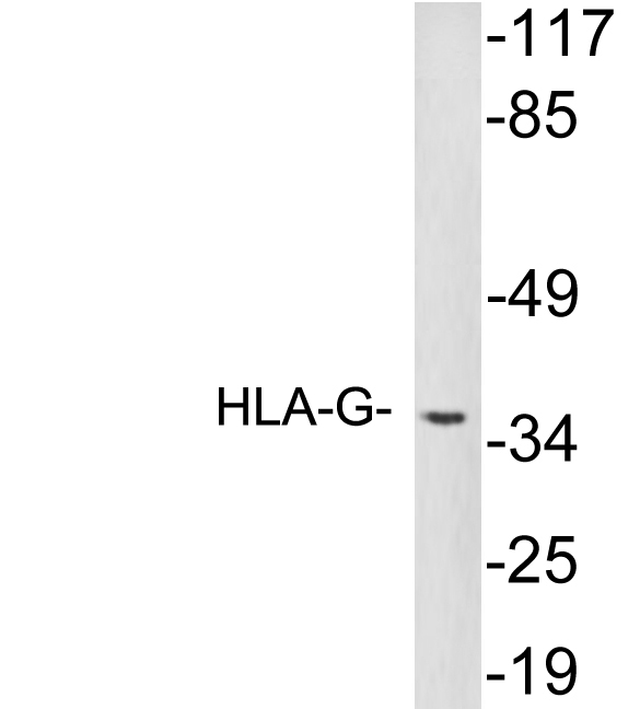 Anti-HLA-G Antibody