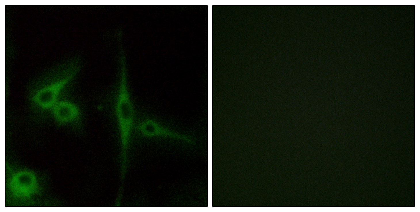 Anti-ELTD1 Antibody