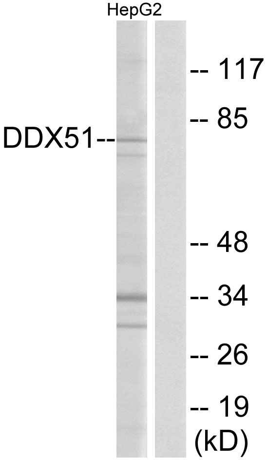 Anti-DDX51 Antibody