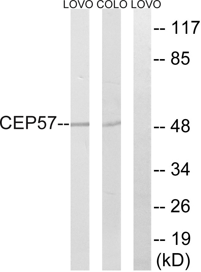 Anti-CEP57 Antibody