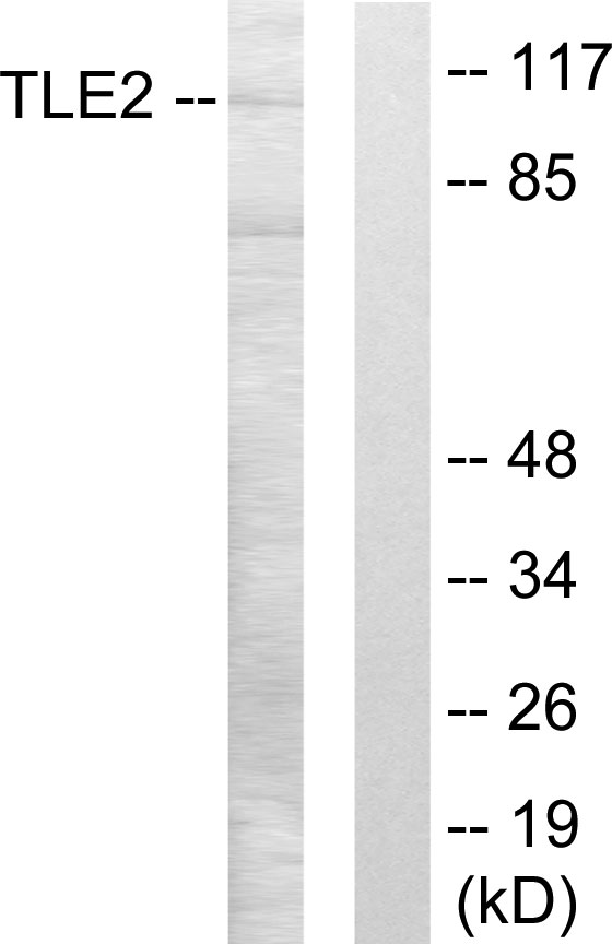 Anti-TLE2 Antibody