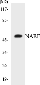 Anti-NARF Antibody