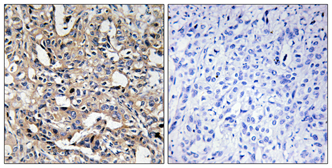 Anti-BAX Antibody