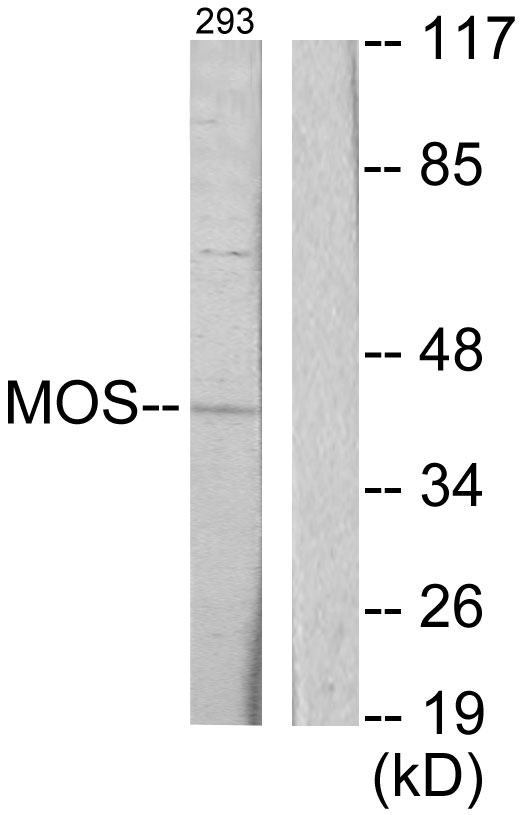 Anti-MOS Antibody