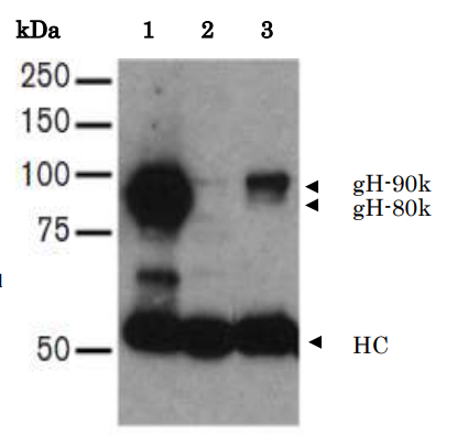 Anti-HHV-7 gH Antibody [2]