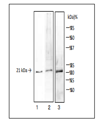 Anti-TDH Toxin + TRH Toxin Antibody [vp-01]