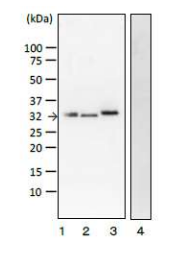 Anti-Vero Toxin Antibody [vero-01]