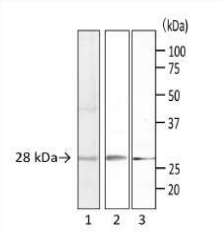 Anti-Staphylococcus Enterotoxin A Antibody [sa-01]