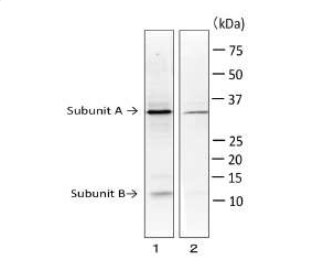 Anti-E. coli LT Toxin Subunit A Antibody [ec-01]