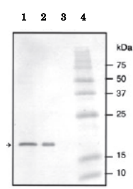 Anti-Streptococcus NADase Inhibitor Antibody