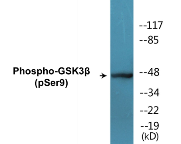 GSK3 beta (phospho Ser9) Cell Based ELISA Kit