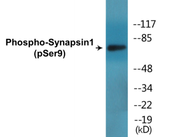 Synapsin1 (phospho Ser9) Cell Based ELISA Kit