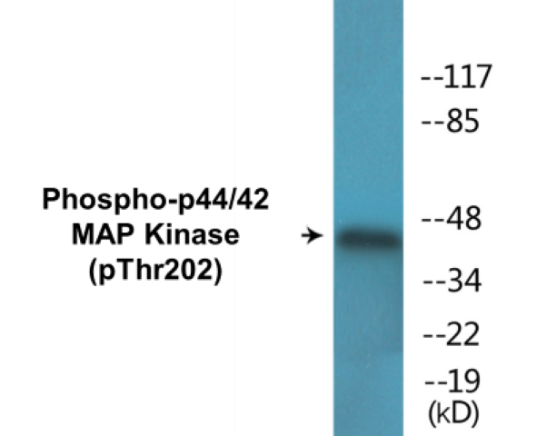 p44/42 MAP Kinase (phospho Thr202) Cell Based ELISA Kit